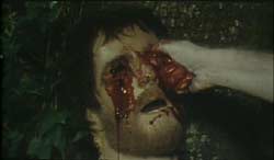 drb 2 Dr Butcher MD (aka Zombie Holocaust)