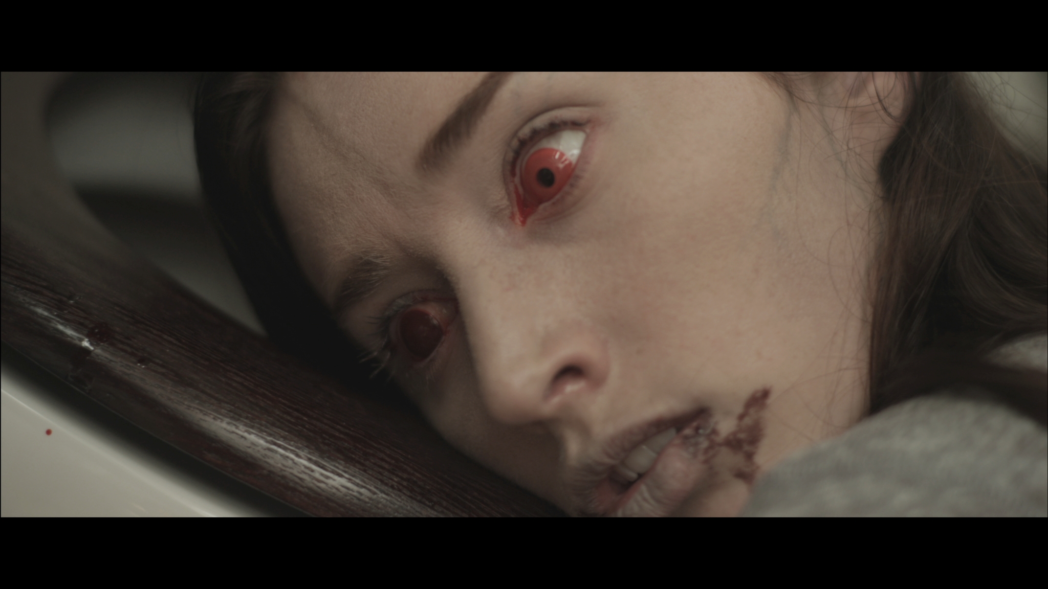 'Contracted' Trailer Can't Cover Up the Scars... - Bloody Disgusting