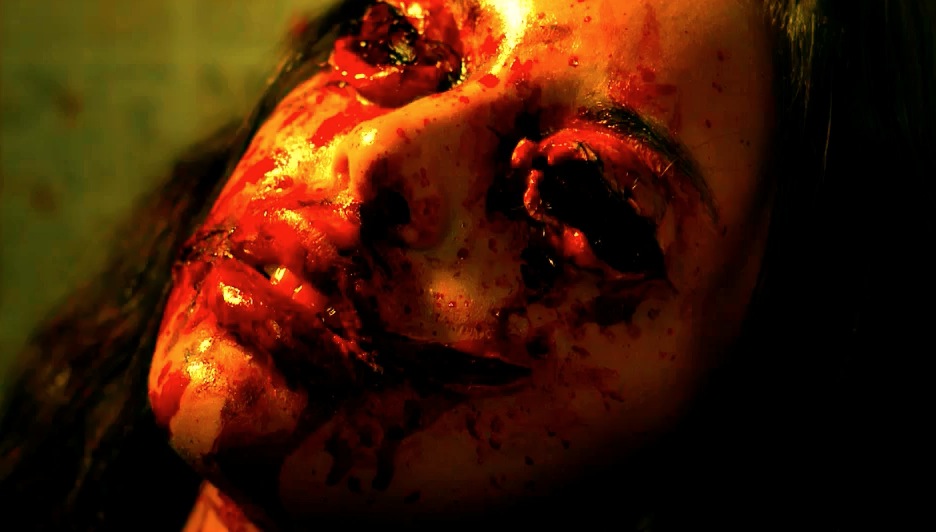 Scar Tissue