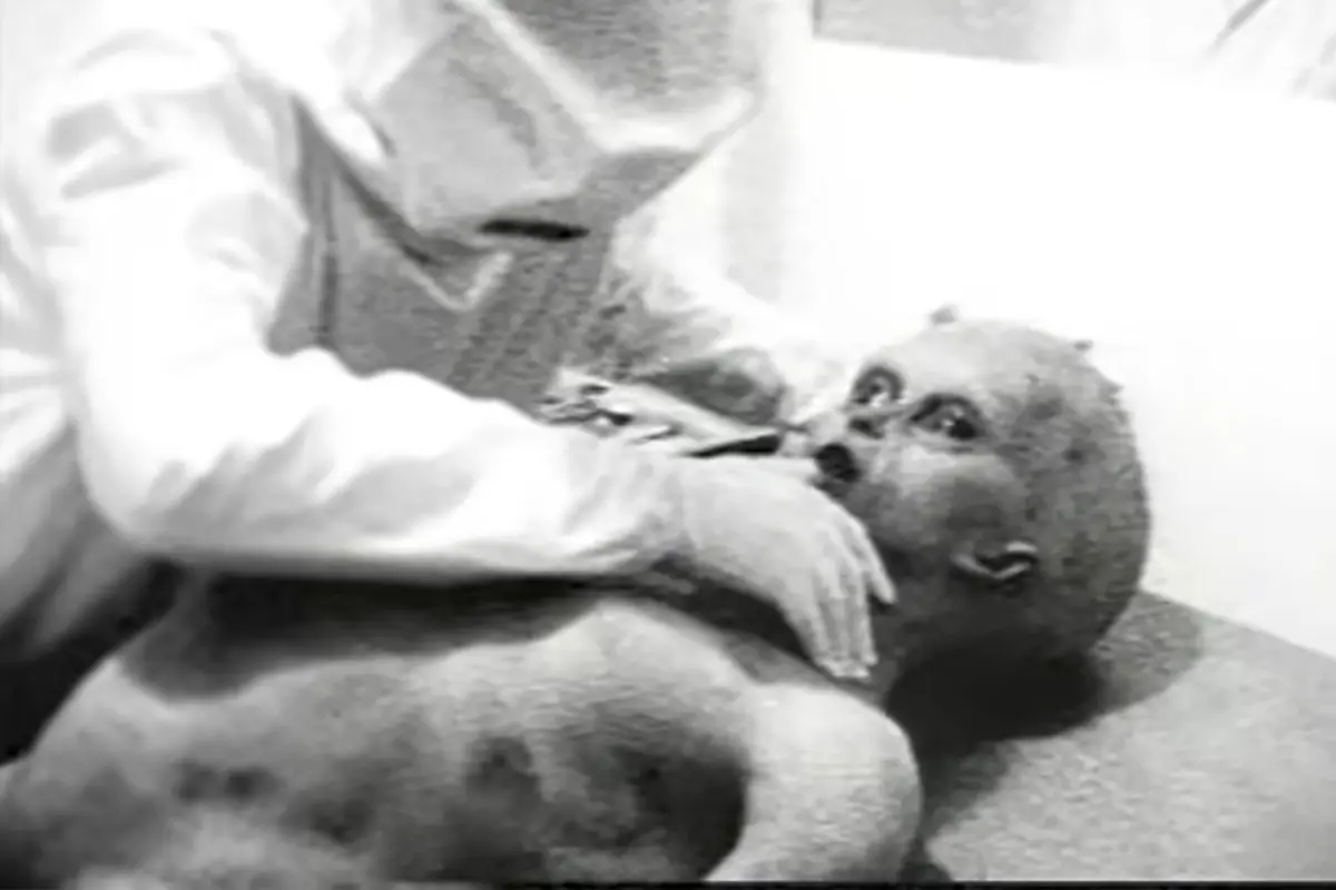 Alien Autopsy: Fact or Fiction